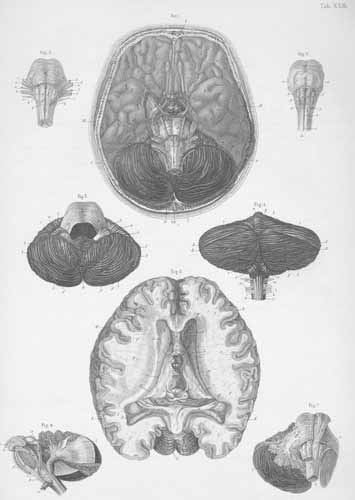 Plate 23: Brain and cerebellum.